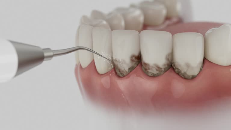 Reliable Dental Implants contractor in Crockett County County, TX by Dentist Open Now